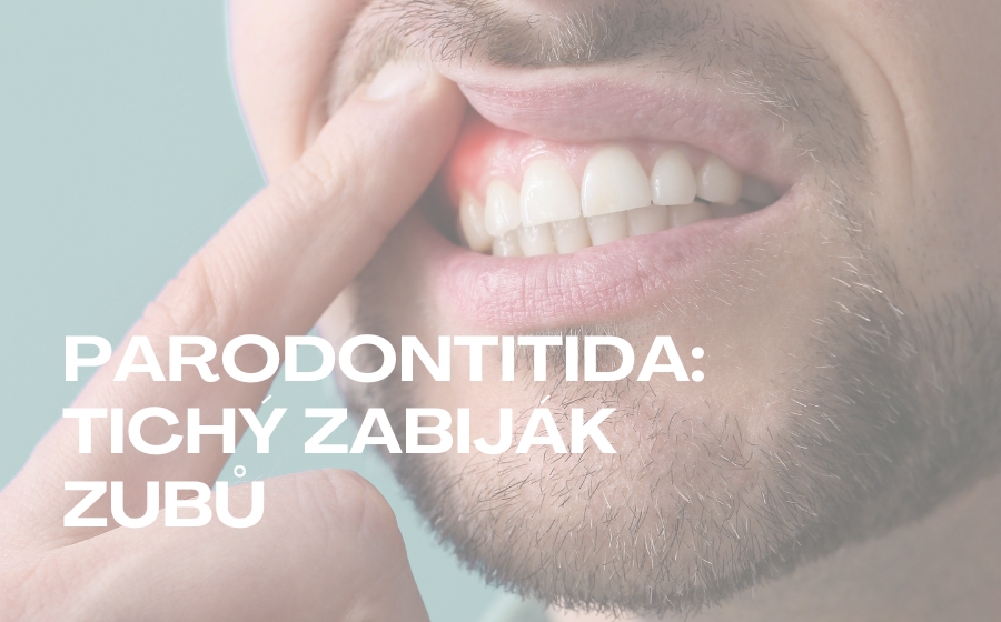CO VÁŠ ČEKÁ NA PRVNÍ NÁVŠTĚVĚ DENTÁLNÍ HYGIENY