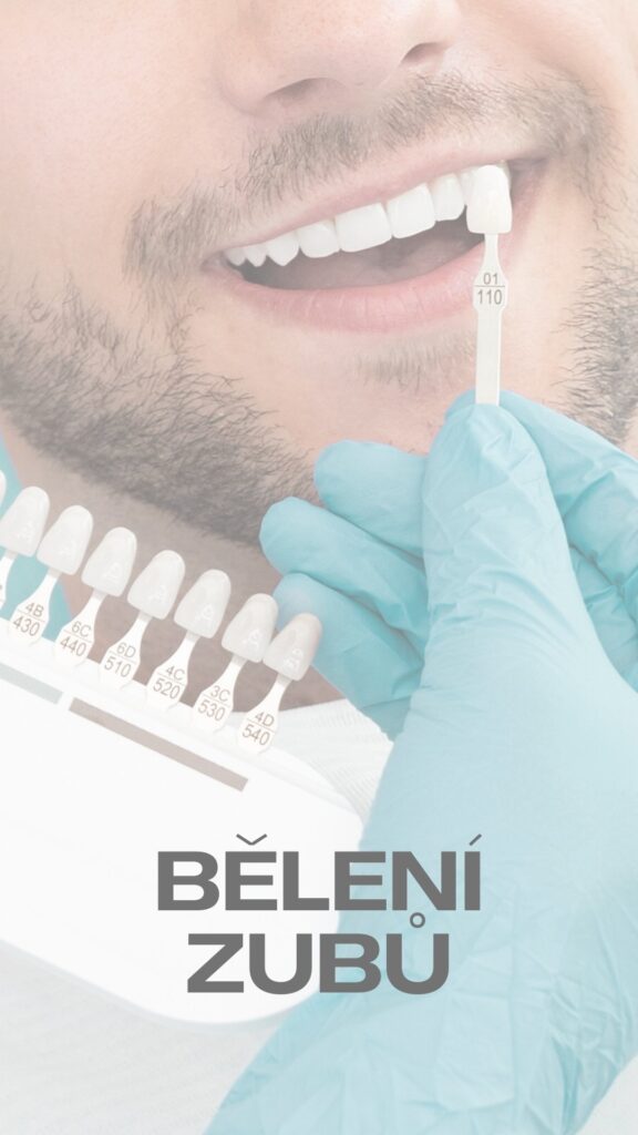 Bělení zubů – bezpečné a efektivní zesvětlení zubů na Vaší zubní klinice