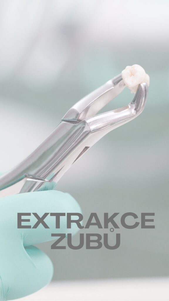 Extraxe zubu – šetrné vytažení zubu bez bolesti ve Vaší zubní klinice