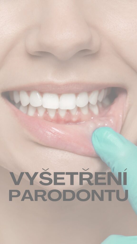 Vyšetření parodontu – odborná diagnostika stavu dásní a zubního lůžka na Vaší zubní klinice