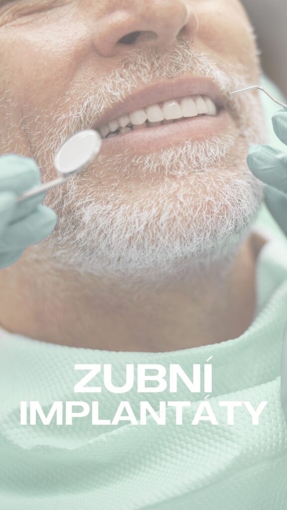 Zubní implantáty – moderní náhrada zubů implantáty na Vaší zubní klinice